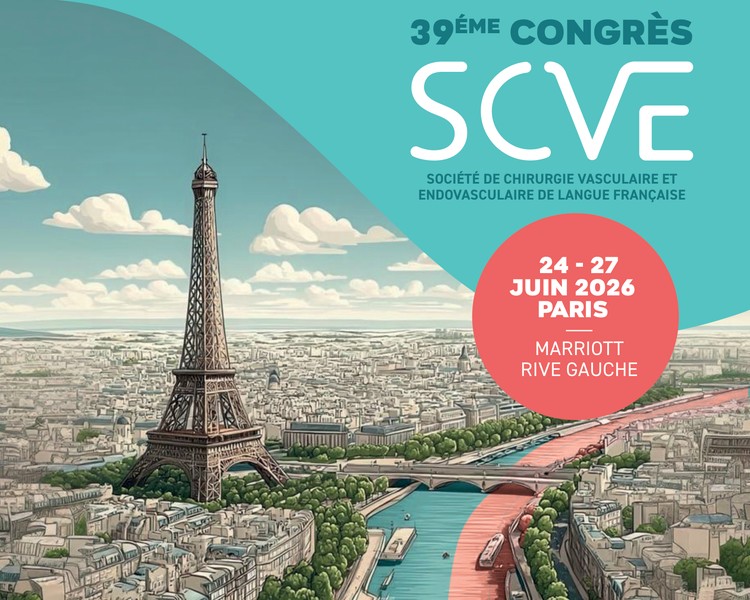 EasyDeasy présent au 39e Congrès de la SCVE à Paris du 24 au 27 juin 2026